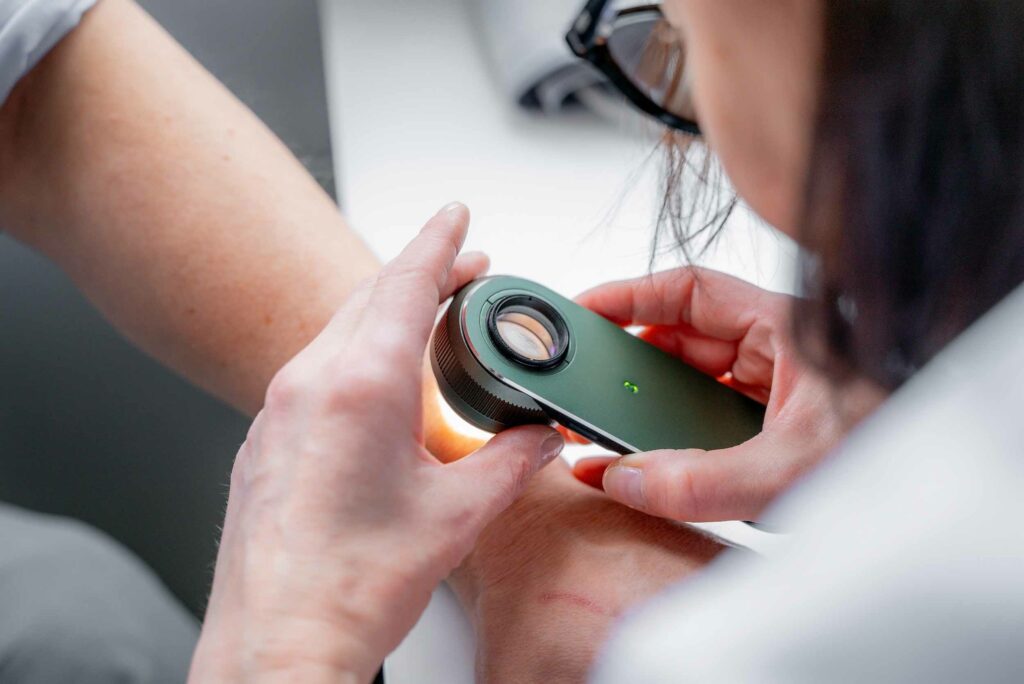 Ihotautilääkäri tutkii potilaan ihoa dermatoskoopilla vastaanotolla Oulussa.
